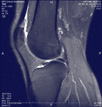 Positieve ervaring Mri centrum